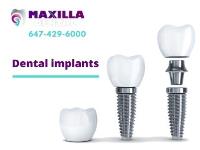 Maxilla Dental image 2